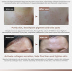 Zenvro LED Skincare Mask