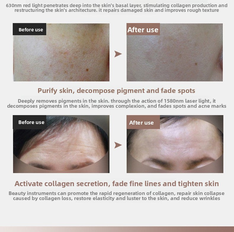 Zenvro LED Skincare Mask